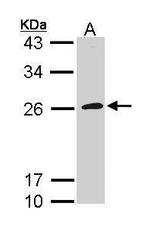 GP1BB Polyclonal Antibody