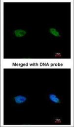 BCCIP Polyclonal Antibody