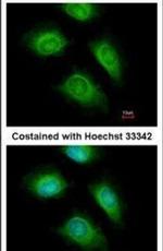 ARF1 Antibody in Immunocytochemistry (ICC/IF)