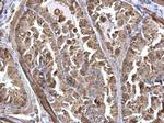 ARF1 Antibody in Immunohistochemistry (Paraffin) (IHC (P))