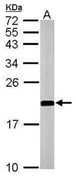 ARF1 Antibody in Western Blot (WB)