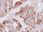 CBS Antibody in Immunohistochemistry (Paraffin) (IHC (P))