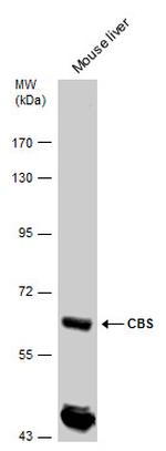 CBS Antibody in Western Blot (WB)