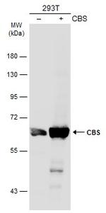 CBS Antibody in Western Blot (WB)
