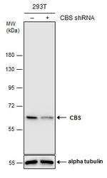 CBS Antibody in Western Blot (WB)