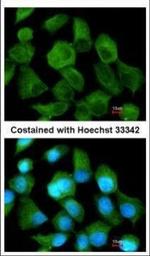 CLN2 Polyclonal Antibody