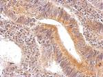 ENO3 Polyclonal Antibody