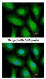 FANCA Polyclonal Antibody