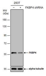 FKBP4 Antibody in Western Blot (WB)
