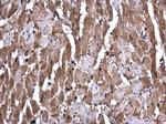 GSTM1 Polyclonal Antibody