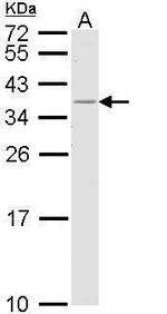 HLA-DR Antibody in Western Blot (WB)