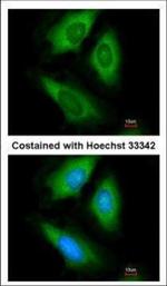 HPRT1 Antibody in Immunocytochemistry (ICC/IF)