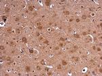 HPRT1 Antibody in Immunohistochemistry (Paraffin) (IHC (P))