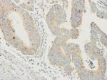 Prodynorphin Polyclonal Antibody