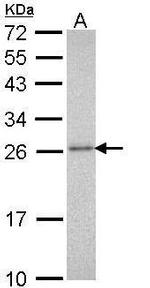 PSMA3 Antibody in Western Blot (WB)