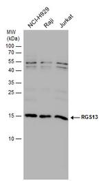 RGS13 Antibody in Western Blot (WB)