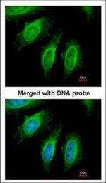 SH3GL1 Antibody in Immunocytochemistry (ICC/IF)