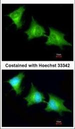 SPR Polyclonal Antibody