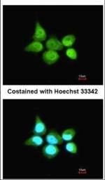TRIM21 Antibody in Immunocytochemistry (ICC/IF)