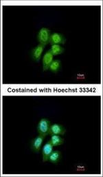 MVP Polyclonal Antibody