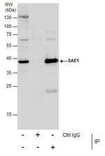 SAE1 Antibody in Immunoprecipitation (IP)
