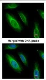 ASL Antibody in Immunocytochemistry (ICC/IF)