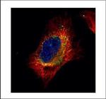 Cofilin 2 Polyclonal Antibody