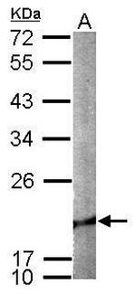 Cofilin 2 Antibody in Western Blot (WB)
