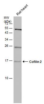 Cofilin 2 Antibody in Western Blot (WB)