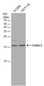 Cofilin 2 Antibody in Western Blot (WB)