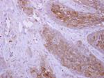 DPYD Polyclonal Antibody