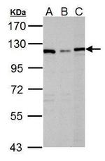 DPYD Antibody in Western Blot (WB)