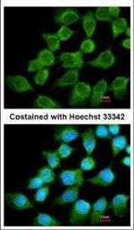 NDUFS1 Antibody in Immunocytochemistry (ICC/IF)