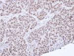 NR0B2 Antibody in Immunohistochemistry (Paraffin) (IHC (P))