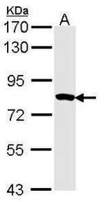 MTMR2 Antibody in Western Blot (WB)