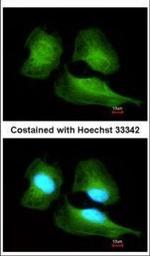 Cullin 7 Polyclonal Antibody