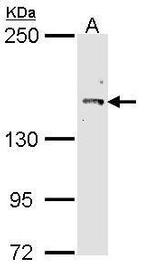 Cullin 7 Antibody in Western Blot (WB)