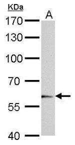 UGT1A6 Antibody in Western Blot (WB)