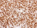 PMM2 Polyclonal Antibody