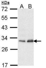 PMM2 Antibody in Western Blot (WB)