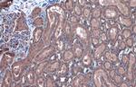 GBA Polyclonal Antibody