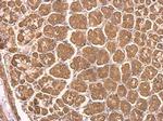 NDUFS8 Antibody in Immunohistochemistry (Paraffin) (IHC (P))
