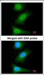 Livin Antibody in Immunocytochemistry (ICC/IF)