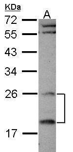 RGS4 Antibody in Western Blot (WB)