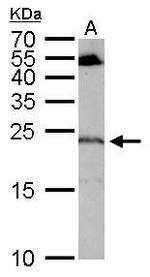RGS4 Antibody in Western Blot (WB)