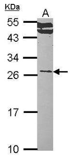 RALA Antibody in Western Blot (WB)
