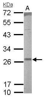 RALA Antibody in Western Blot (WB)