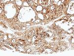 ALPPL2 Antibody in Immunohistochemistry (Paraffin) (IHC (P))