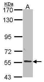 ALPPL2 Antibody in Western Blot (WB)