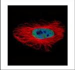 Arylsulfatase A Polyclonal Antibody